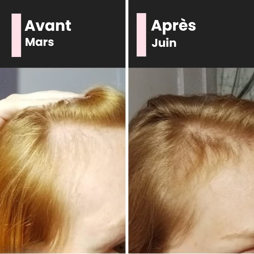 Sérum Croissance & Anti-Chute