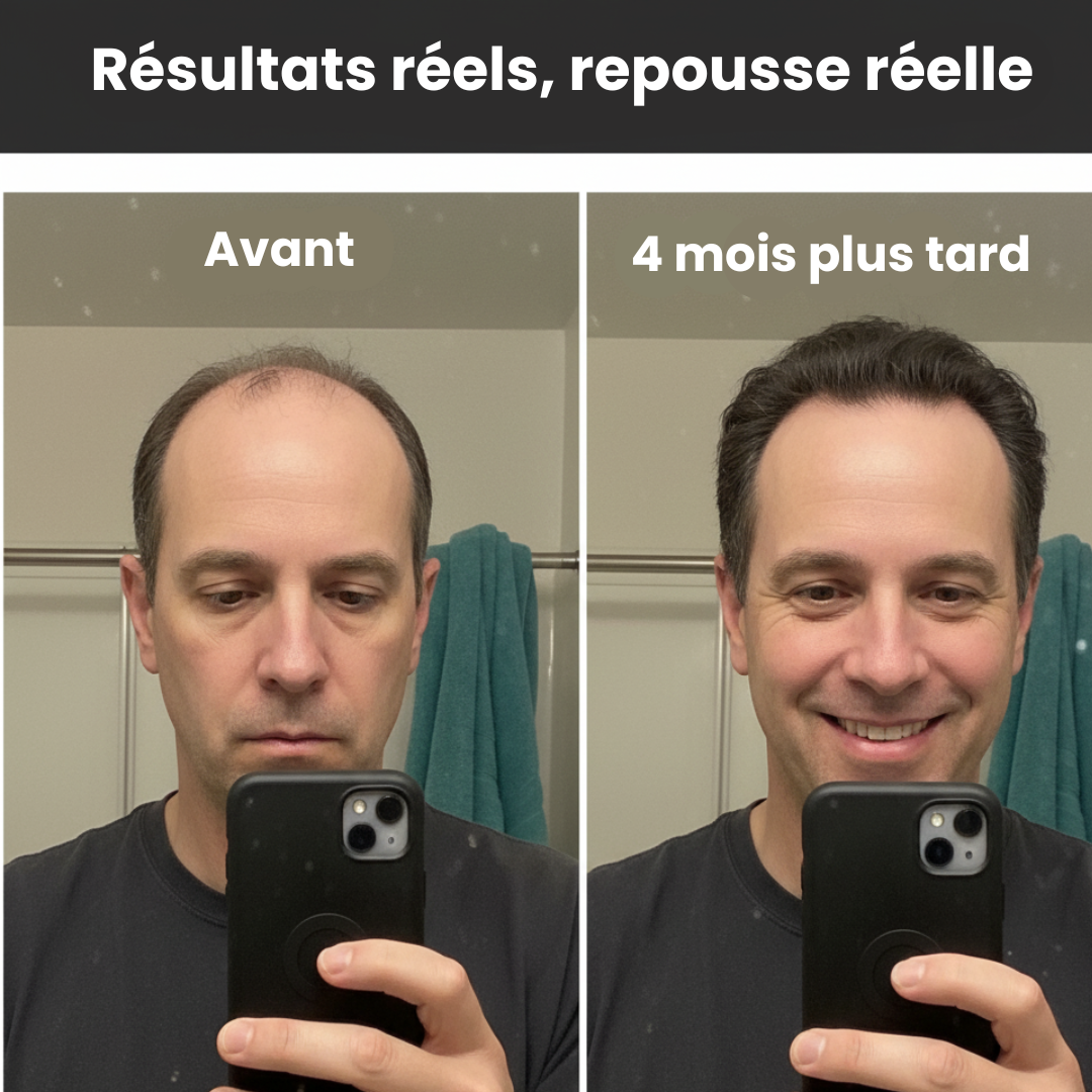 Sérum Croissance & Anti-Chute